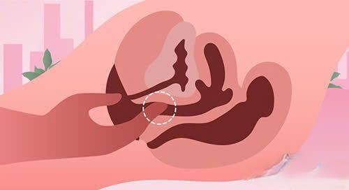 Rạo Rực Điểm G Là Gì? Cách Kích Thích Và Tăng Khoái Cảm