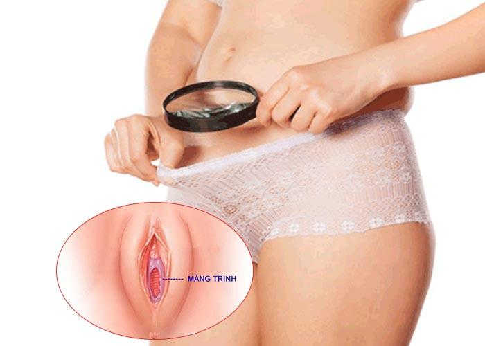 Phẫu Thuật Vá Màng Trinh: Có Phát Hiện Được Không Và Có Nguy Hiểm Không?