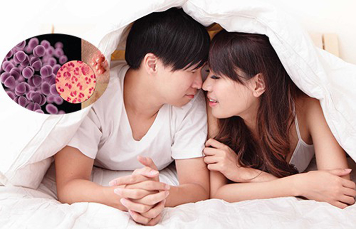 Bệnh Chlamydia Có Chữa Được Không? Cách Phòng Chống Hiệu Quả Từ Chuyên Gia