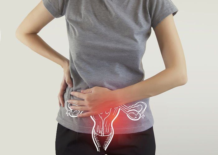 U Xơ Tử Cung Nên Kiêng Gì, Ăn Gì Và Tập Luyện Ra Sao Để Kiểm Soát Bệnh?