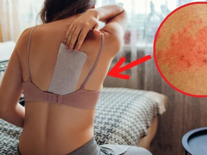 Bị Bệnh Herpes Có Nguy Hiểm Không? Dấu Hiệu Nhận Biết Và Cách Điều Trị Hiệu Quả