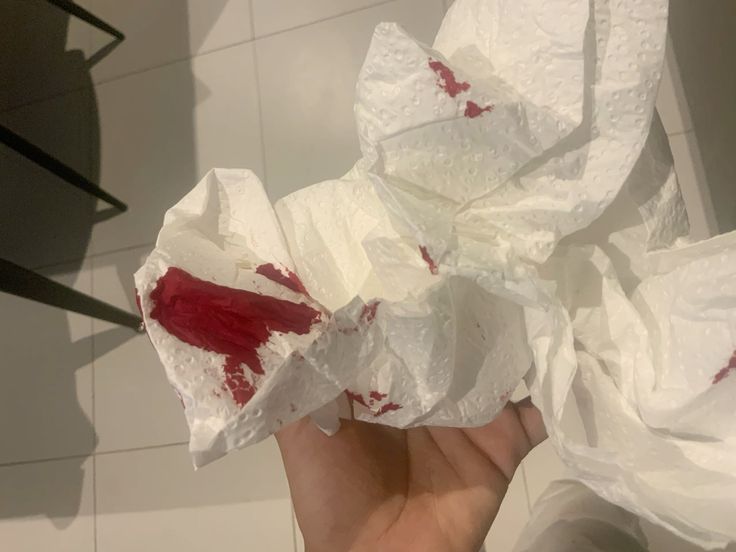 Chảy máu dương vật khi quan hệ có nguy hiểm không? Nguyên nhân và cách xử lý đúng