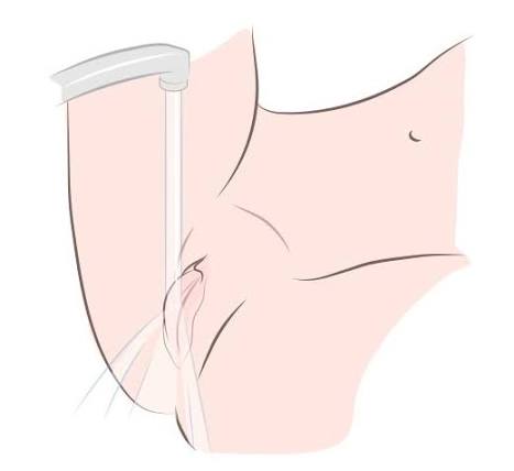 Hướng Dẫn Cách Kích Thích Âm Vật Đúng Cách Giúp Nàng Thăng Hoa