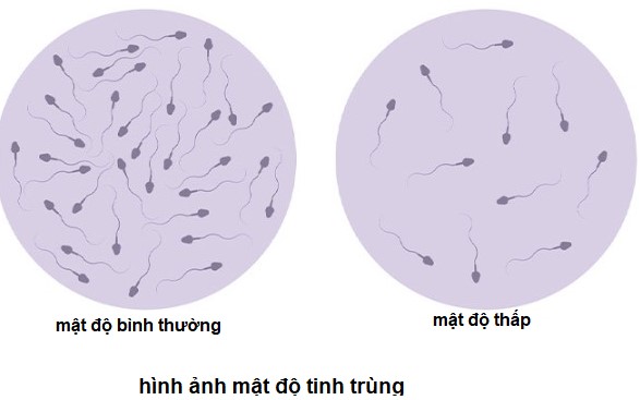 Mật Độ Tinh Trùng Là Gì? Chỉ Số Quan Trọng Trong Tinh Dịch Đồ
