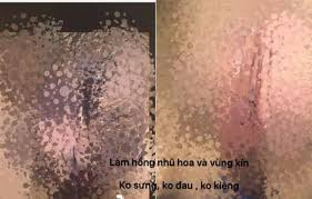 Làm hồng vùng kín tại nhà
