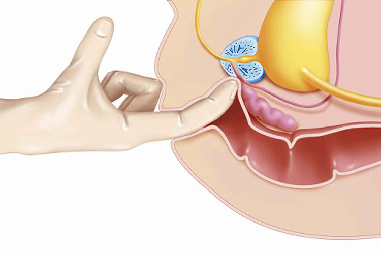 Thủ Dâm Hậu Môn Là Gì? Hướng Dẫn An Toàn Và Những Điều Cần Biết Cho Cả Nam Và Nữ