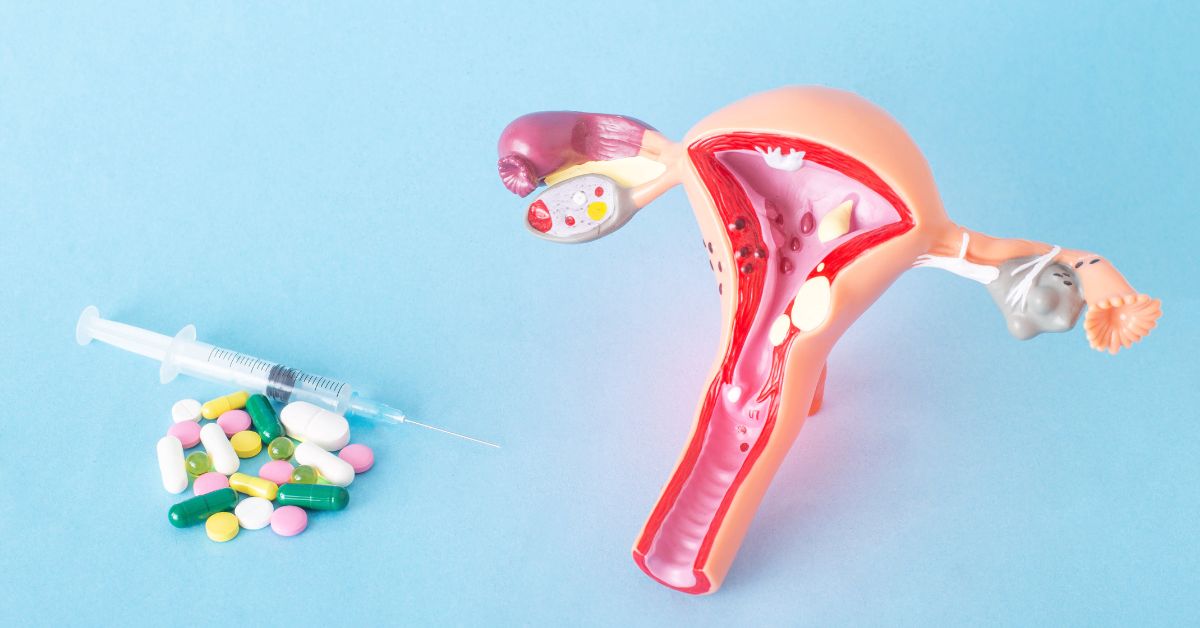 Trichomoniasis Là Bệnh Gì? Lây Qua Đâu Và Dấu Hiệu Cần Nhận Biết
