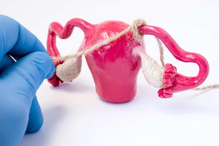 Triệt Sản Ở Nữ Giới Có Hại Không? Giải Đáp Về Khả Năng Sinh Con Sau Khi Triệt Sản