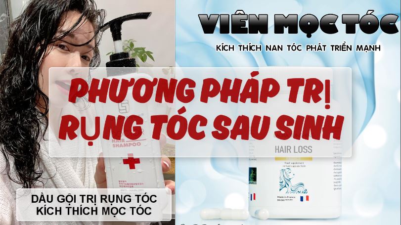 PHƯƠNG PHÁP ĐIỀU TRỊ RỤNG TÓC SAU SINH HIỆU QUẢ PHƯƠNG PHÁP ĐIỀU TRỊ RỤNG TÓC SAU SINH HIỆU QUẢ