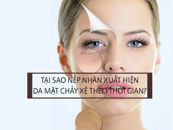 TẠI SAO NẾP NHĂN XUẤT HIỆN, DA MẶT CHẢY XỆ THEO THỜI GIAN? TẠI SAO NẾP NHĂN XUẤT HIỆN, DA MẶT CHẢY XỆ THEO THỜI GIAN?