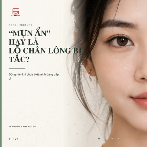 “MỤN ẨN” HAY LÀ LỖ CHÂN LÔNG BỊ TẮC?