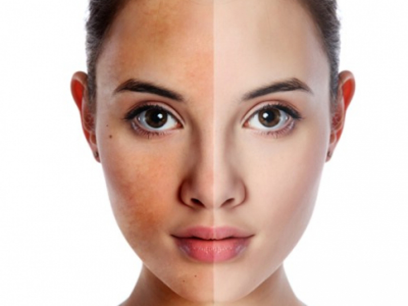 Những yếu tố ảnh hưởng đến da