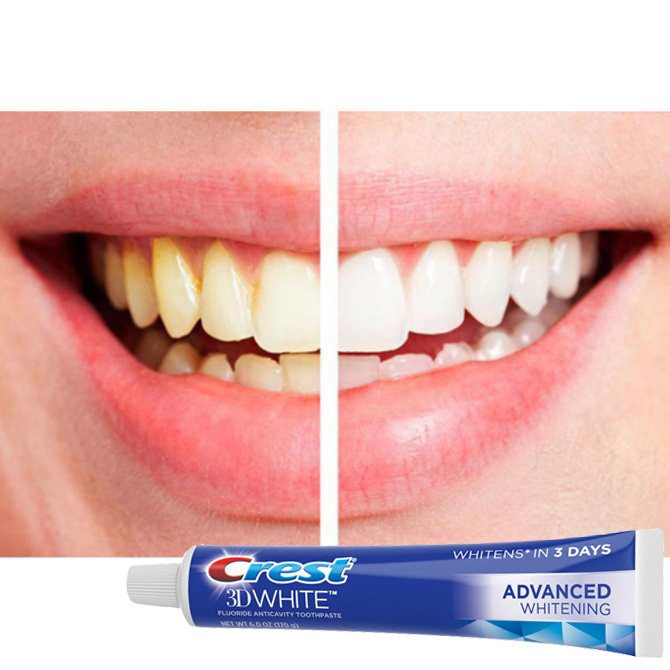 Kem Đánh Răng Crest 3D White Triple Whitening 158g