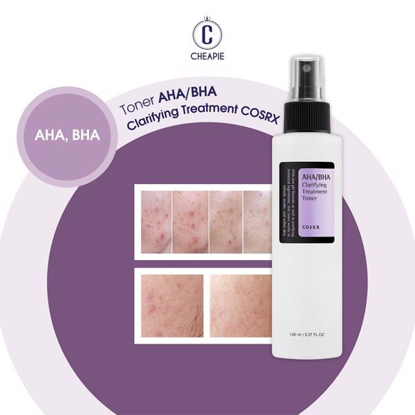 Nước hoa hồng Cosrx AHA/BHA Clarifying Treatment 150ml