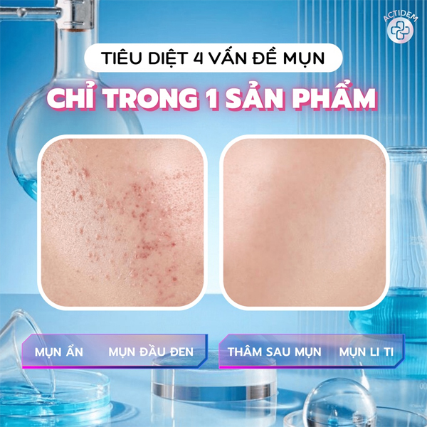 Gel Giảm Mụn Giảm Thâm Actidem Derma Gel 18g