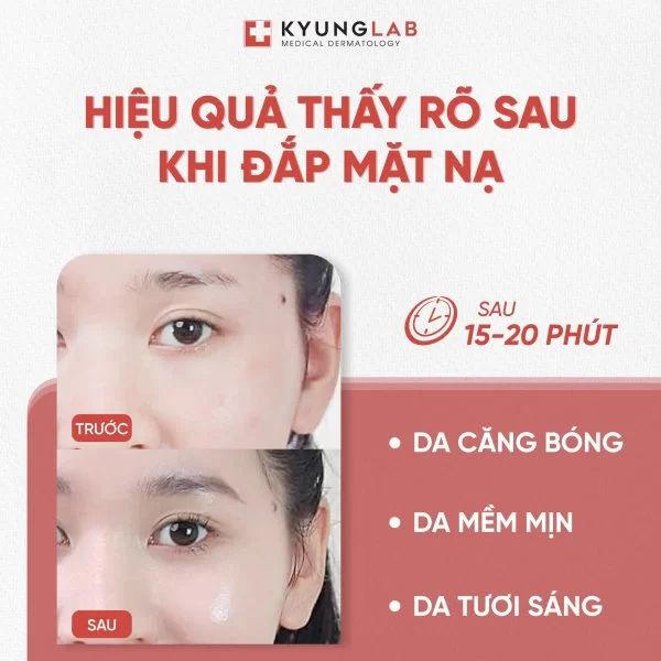 Mặt Nạ Giấy Giúp Làm Dịu Và Săn Chắc Da Kyunglab PDRN Therapy Mask 23ml