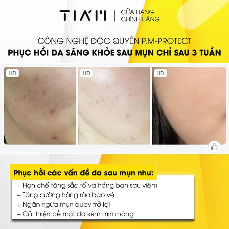 Tinh Chất Dưỡng Trắng Phục Hồi Cho Da Dầu Mụn Nhạy Cảm TIA'M Vita B3 Source (10% Niacinamide + 2% Arbutin) 40ml