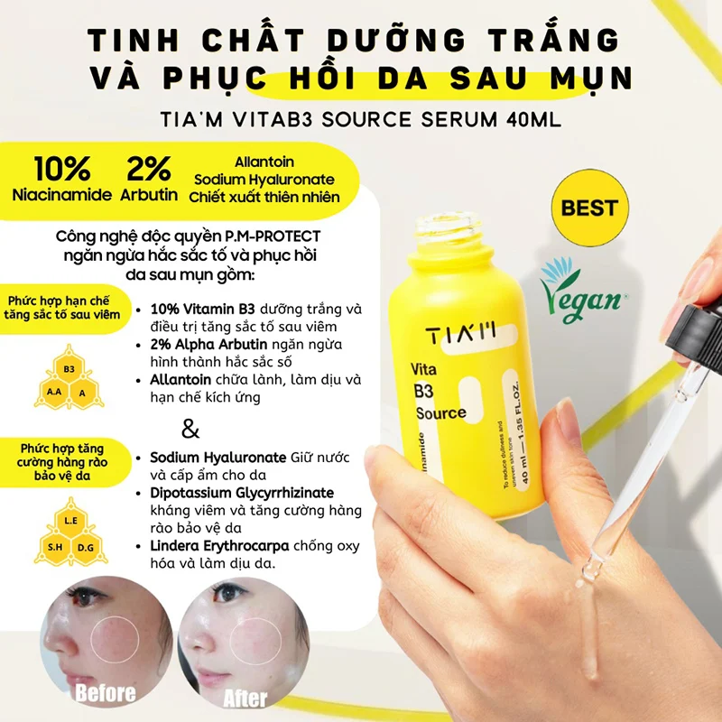 Tinh Chất Dưỡng Trắng Phục Hồi Cho Da Dầu Mụn Nhạy Cảm TIA'M Vita B3 Source (10% Niacinamide + 2% Arbutin) 40ml