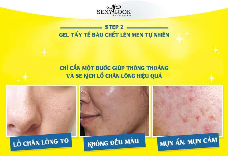 Gel Tẩy Tế Bào Chết Mặt SexyLook Enzyme Exfoliating 120g