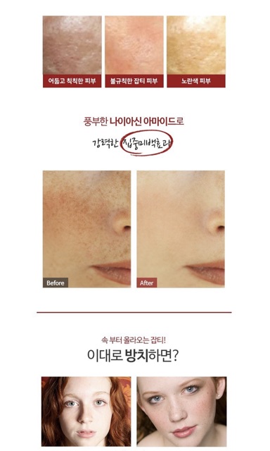 Kem Đặc Trị Melasma-X 3D Whitening Clinic 35ml