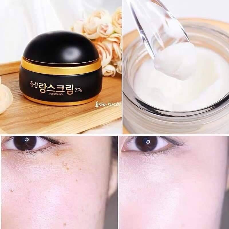 Kem trị nám DongSung Rannce Cream