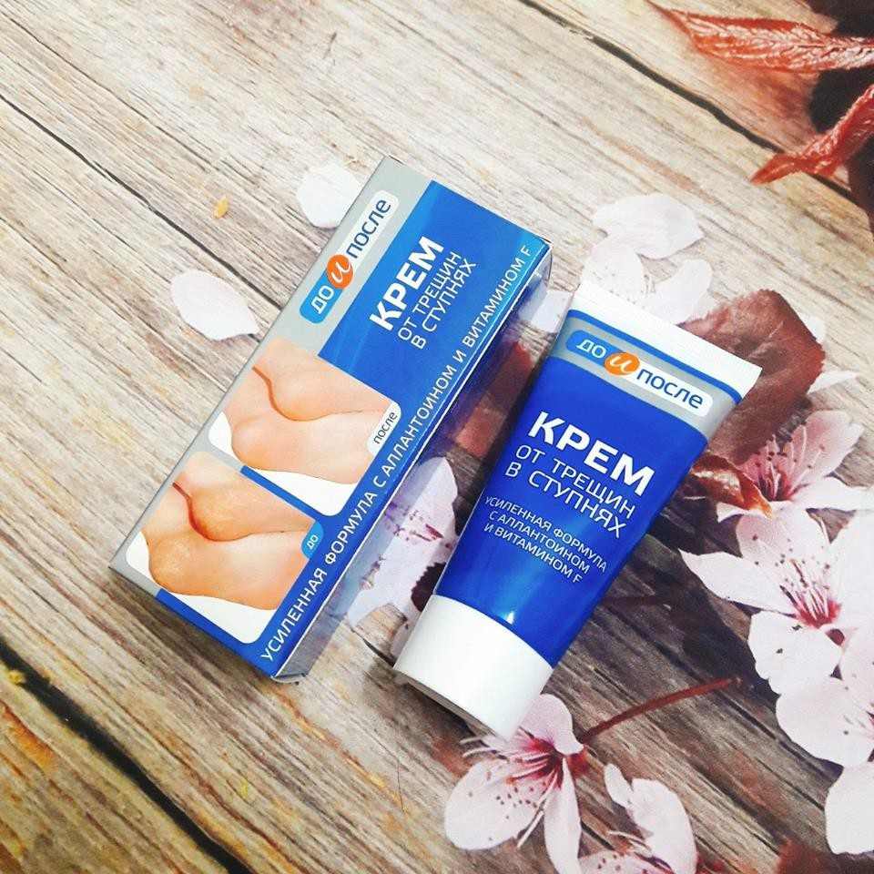 Kem Trị Nứt Nẻ Gót Chân Kpem Nga 50ml