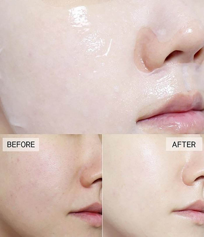 Mặt Nạ Nhau Thai Ủ Trắng Da Rwine Beauty Placenta Face Cleanser