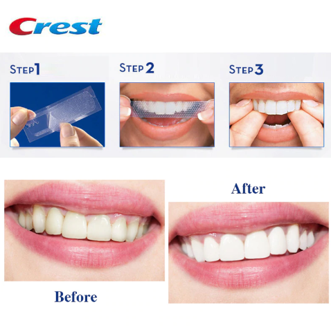 Miếng Dán Trắng Răng Crest 3D Whitestrips Dental Whitening Kit – 1 Hour Express