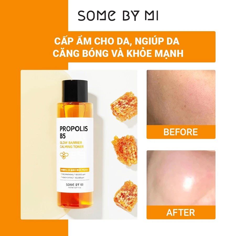 Nước Hoa Hồng Dưỡng Ẩm, Phục Hồi Da Some By Mi Propolis B5 Glow Barrier Calming 150ml