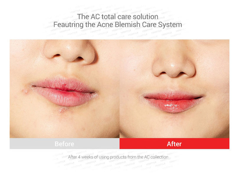 Serum Cosrx AC Blemish Spot Clearing 40ml