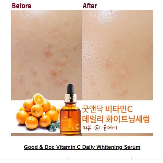Serum Dưỡng Trắng Trị Thâm Goodndoc Vitamin C-16.5 Daily Whitening Serum 30ml