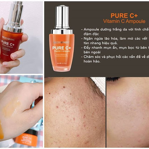 Serum Mediskinbyc Pure C+ Vitamin C Ampoule 30ml