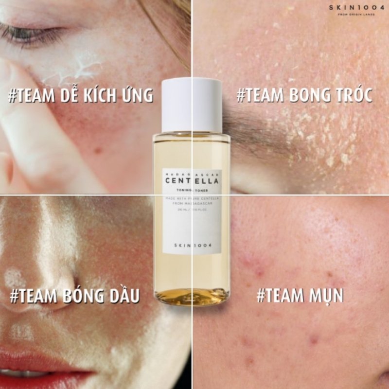 Nước Hoa Hồng Skin1004 Madagascar Centella Asiatica Toning 210ml
