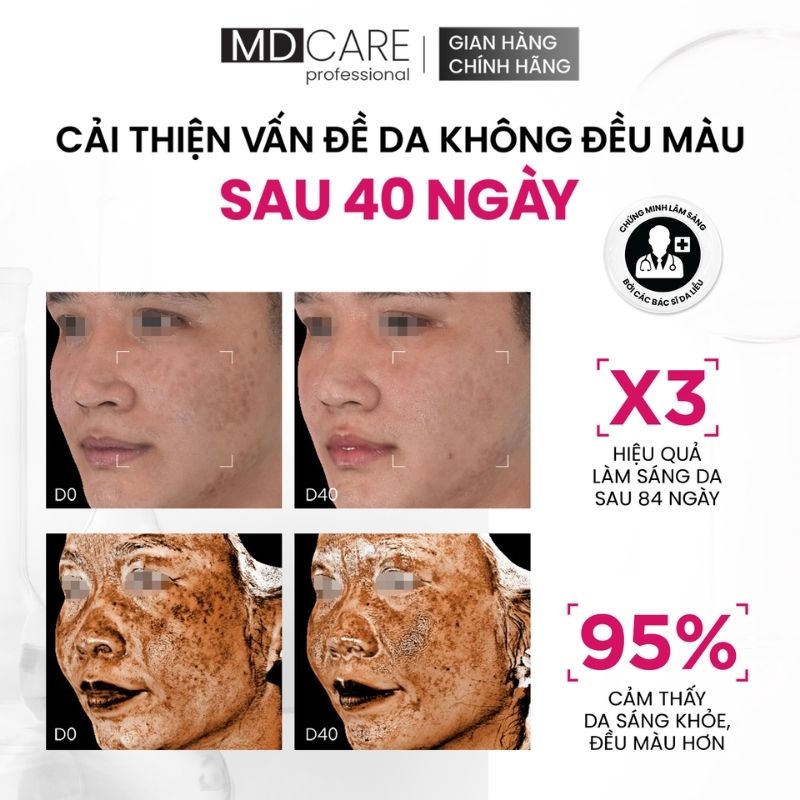 Tinh Chất Dưỡng Sáng, Mờ Thâm MD Care Brightenyl Serum 30ml