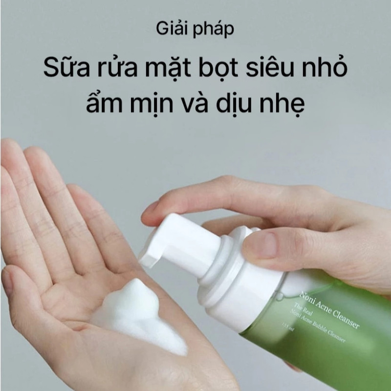 Sữa Rửa Mặt Celimax The Real Noni Acne Bubble Cleanser 155ml