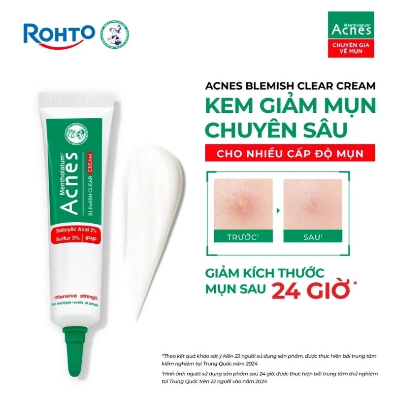 Kem Chấm Mụn Chuyên Sâu Acnes Blemish Clear Cream 10g