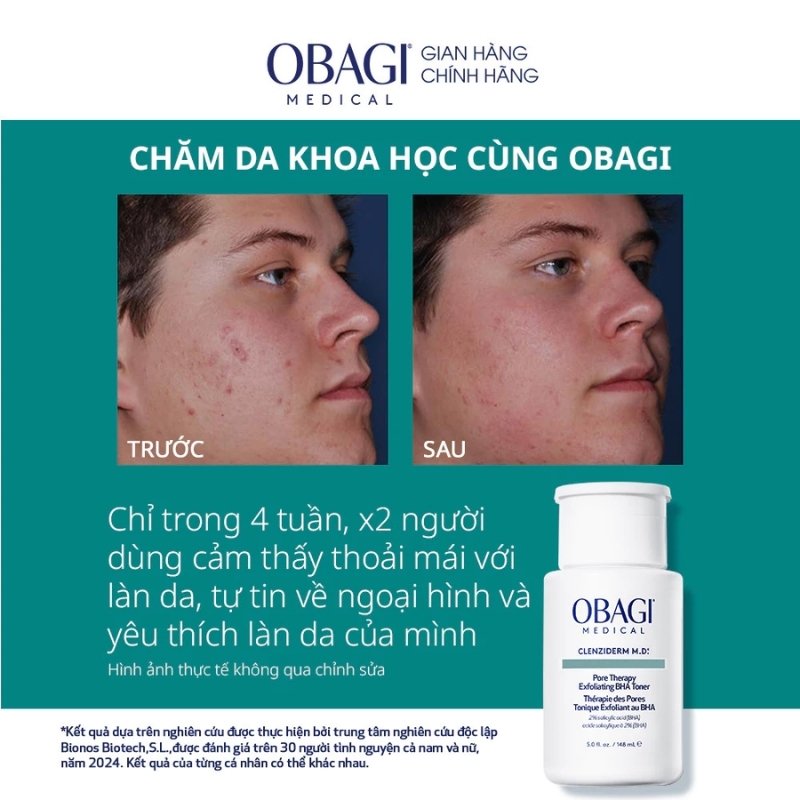 Dung Dịch Trị Mụn Tẩy Tế Bào Chết Obagi Clenziderm MD Pore Therapy Salicylic Acid 2% 148ml (Nhập Khẩu)
