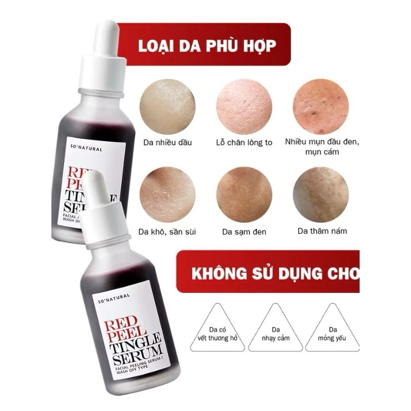 Tinh Chất Tái Tạo Da So Natural Red Peel Tingle Serum Facial Peeling