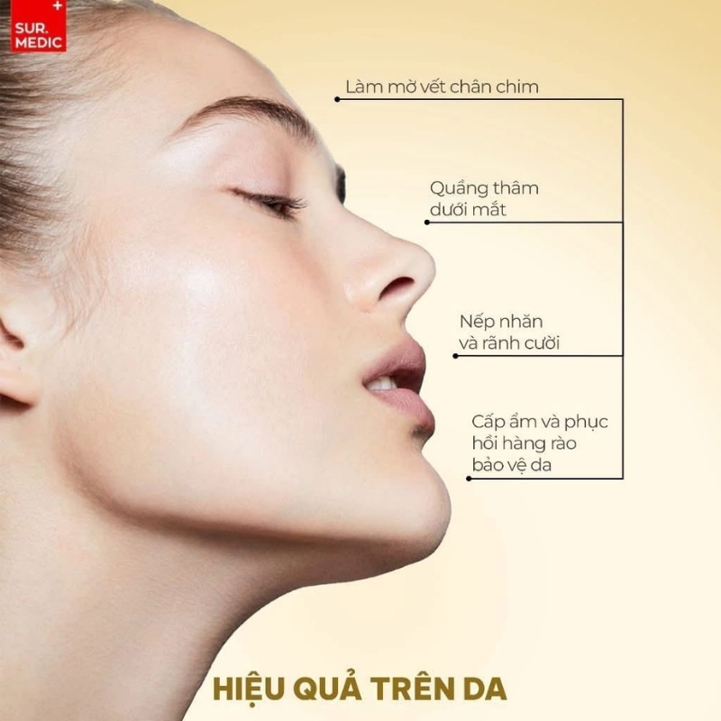 Kem Dưỡng Mắt Sur.Medic Cải Thiện Nếp Nhăn, Mờ Thâm Perfection 100™ All In One Facial Eye Cream 35ml