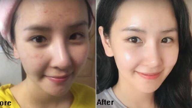Tinh chất dưỡng da Dr.AG BHA+Clear First Cell Essence 150ml