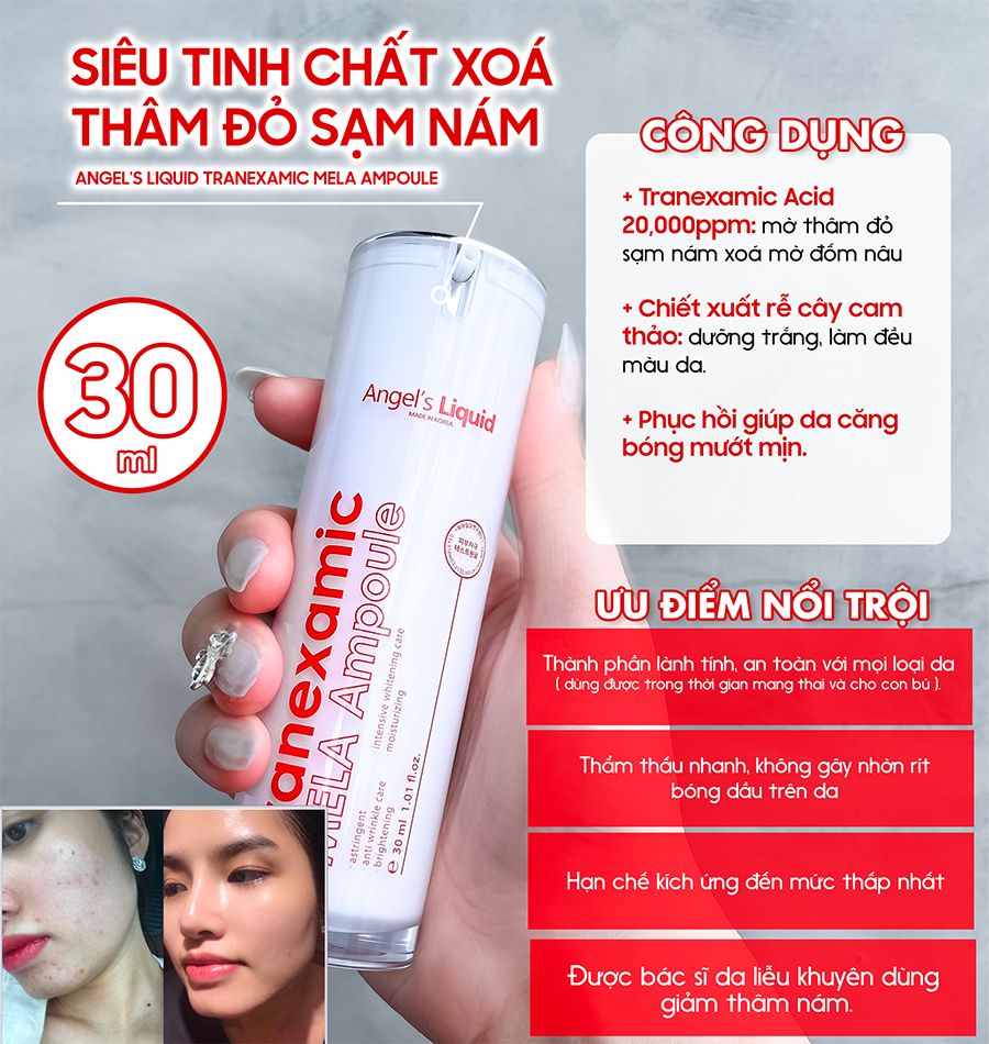 Tinh Chất Mờ Nám Chuyên Sâu Angel's Liquid Tranexamic Mela Ampoule 30ml