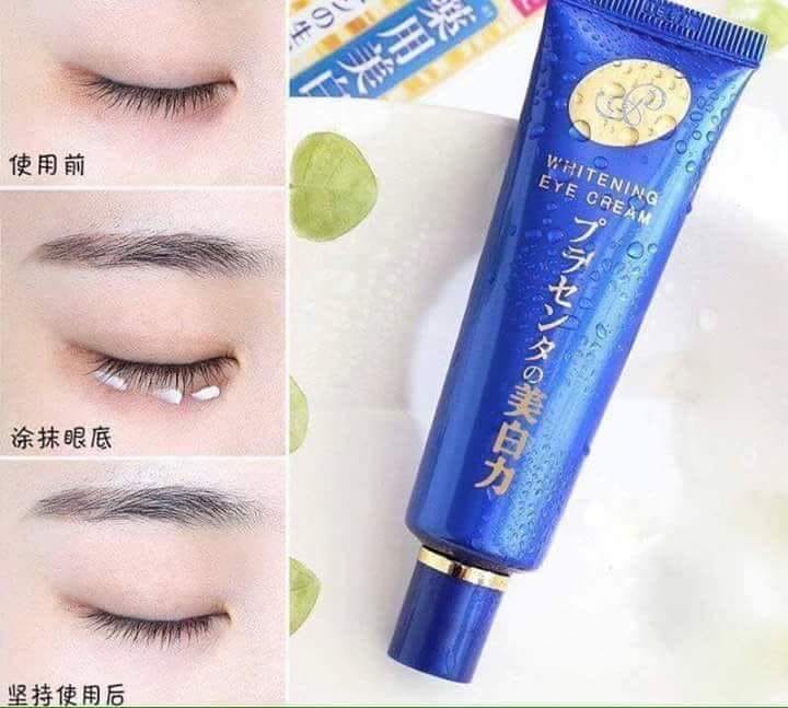 Kem trị thâm mắt MEISHOKU WHITENING EYE 30g