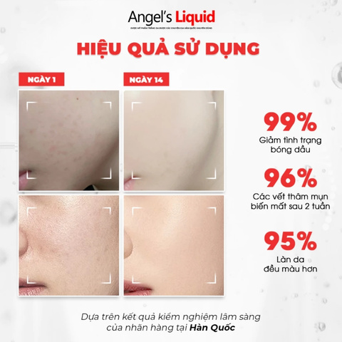 Serum Angel’s Liquid Dưỡng Trắng, Kiểm Soát Dầu, Thu Nhỏ Lỗ Chân Lông Glutathione+Niacinamide Cica 45ml