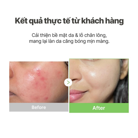 Toner Pad Medicube Exosome Cica Calming 150ml (100 Miếng)