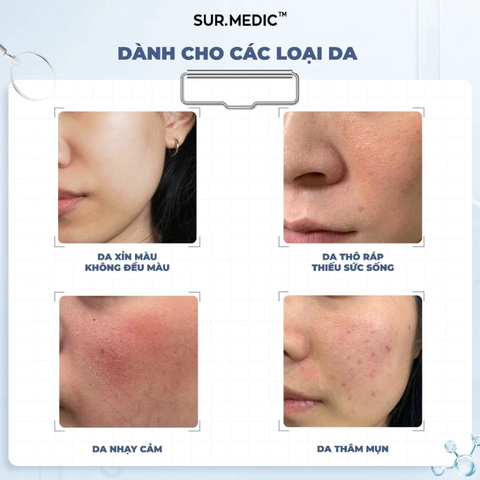 Tinh Chất Sur.Medic Super Glutathione 1000 Bright Ampoule 32ml