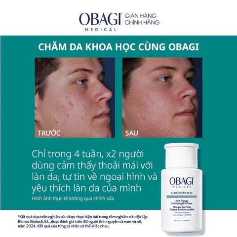 Dung Dịch Trị Mụn Tẩy Tế Bào Chết Obagi Clenziderm MD Pore Therapy Salicylic Acid 2% 148ml (Nhập Khẩu)