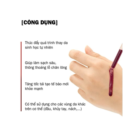 Tinh Chất Tái Tạo Da So Natural Red Peel Tingle Serum Facial Peeling