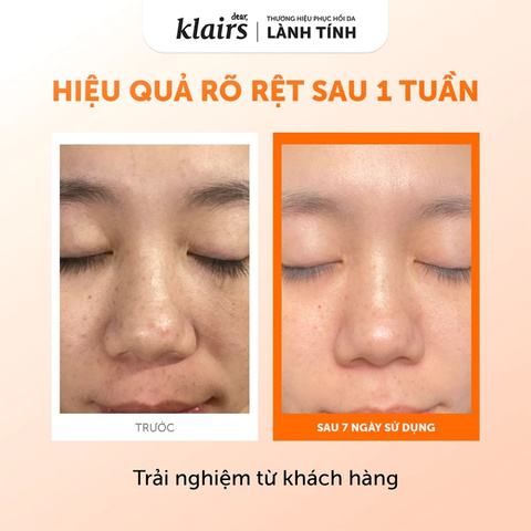 Nước Hoa Hồng Sáng Da Dear, Klairs Freshly Juiced Vitamin Essence Toner 180ml