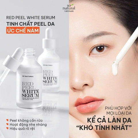 Tinh Chất Dưỡng Trắng Làm Đều Màu Da So Natural Red Peel White 35ml