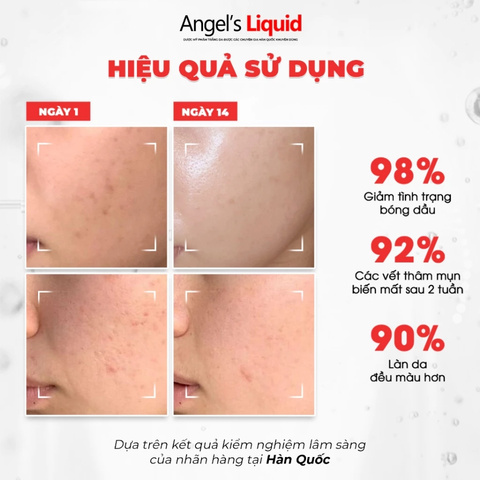 Kem Dưỡng Trắng Kiểm Soát Dầu, Thu Nhỏ Lỗ Chân Lông Angel’s Liquid Glutathione Plus Niacinamide Cica 50ml